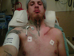 After hardware removed due to infection from metals not being sterile. Got a Neck Cathater with hardcore iv meds.